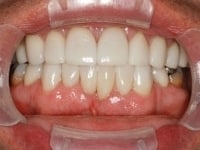 Konig Center for Cosmetic & Comprehensive Dentistry smile photos